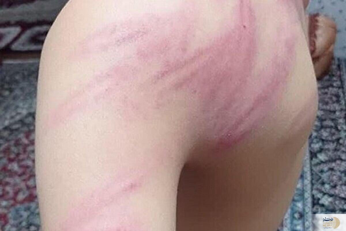جزئیات تازه از تنبیه بدنی دانش آموز سنندجی