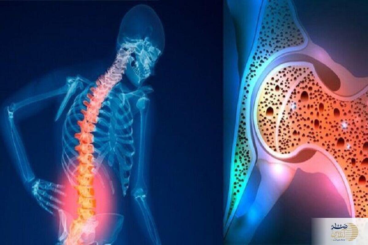 از پوکی استخوان نترسید؛ با خوردن این میوه استخوان‌های خود را قوی کنید!