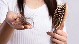 بشنوید| ریزش مو پس از کرونا: چرا این مشکل شایع شده است؟