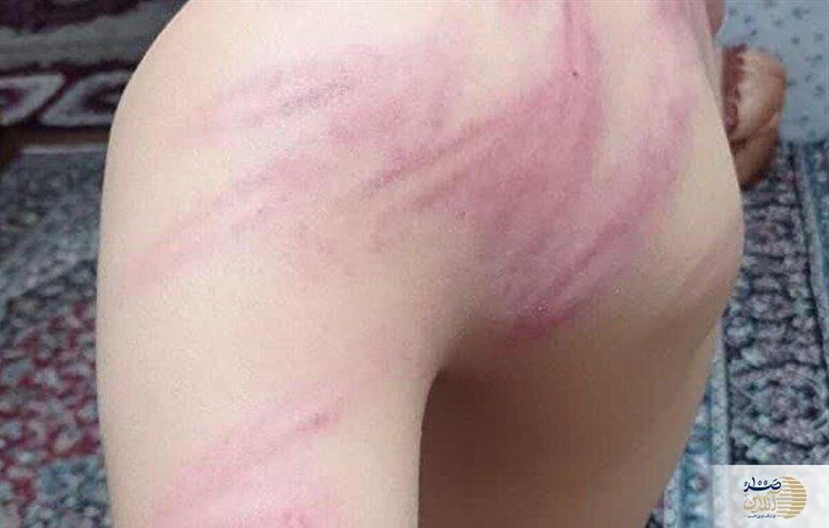 پس از حادثه تنبیه بدنی در روستای کرجو، معلم خاطی اخراج شد