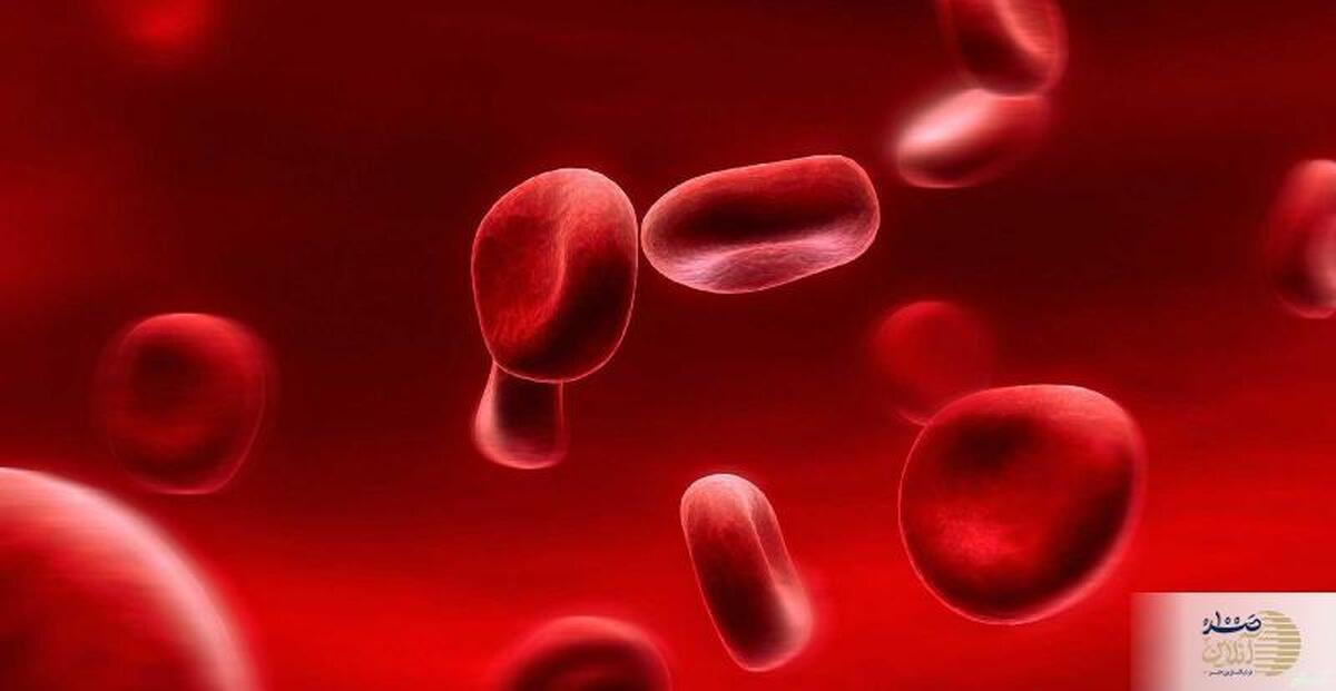 علائم بالا بودن کلسترول/ همه چیز را قبل از دیر شدن بدانید