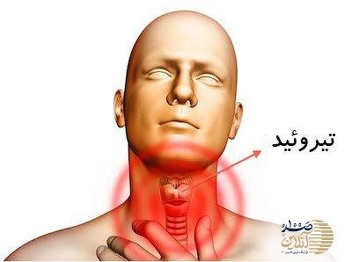بشنوید| کم‌کاری تیروئید چه بلایی سر بدن می‌آورد؟ علائم و راه‌های تشخیص را بشناسید!
