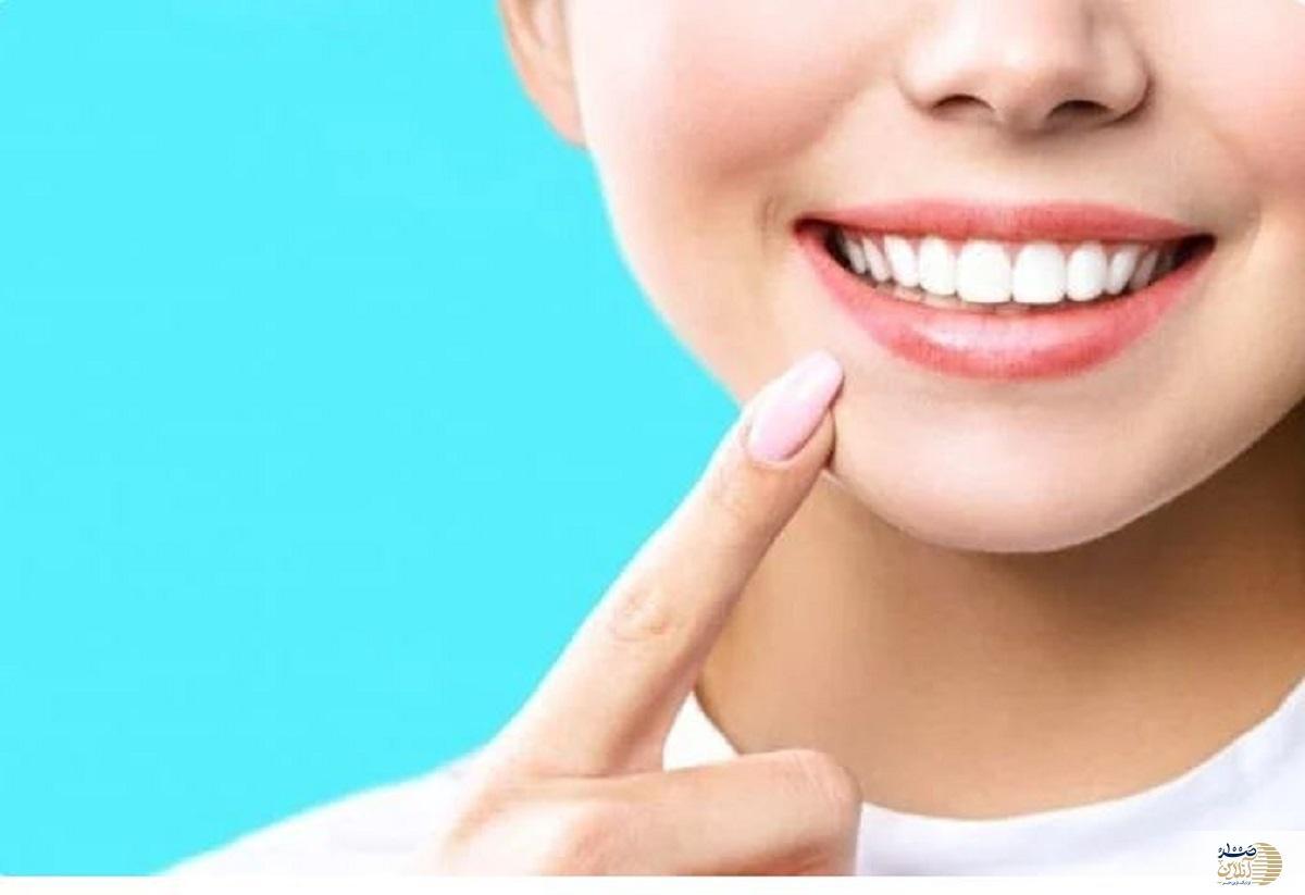 روش های جرم گیری دندان در خانه با نسخه های طب سنتی