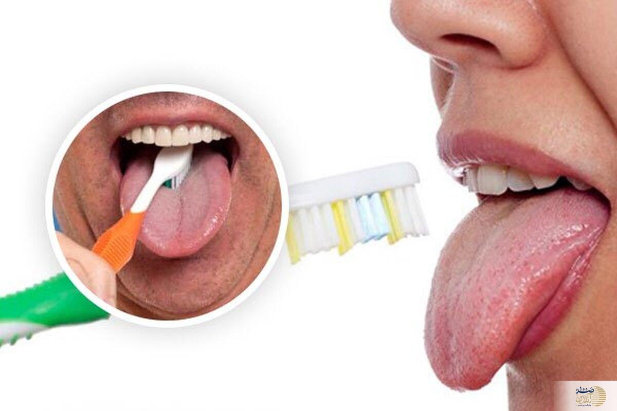 چرا باید زبان را مسواک زد؟