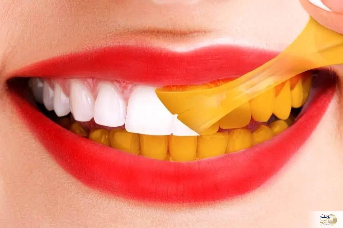 عادت‌هایی که دندان‌های شما را زرد می‌کند/ چگونه از آنها اجتناب کنیم؟