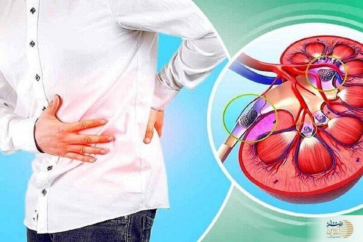 فصل گرما و خطر تشدید بیماری کلیوی | این نشانه‌ها را نادیده نگیرید
