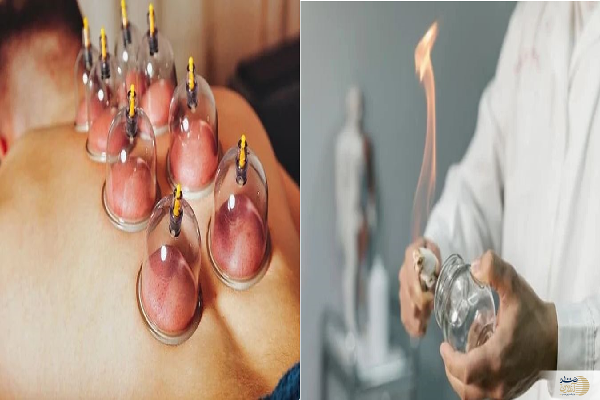 ۶ گروهی که حجامت در بهار برایشان مثل سم است!