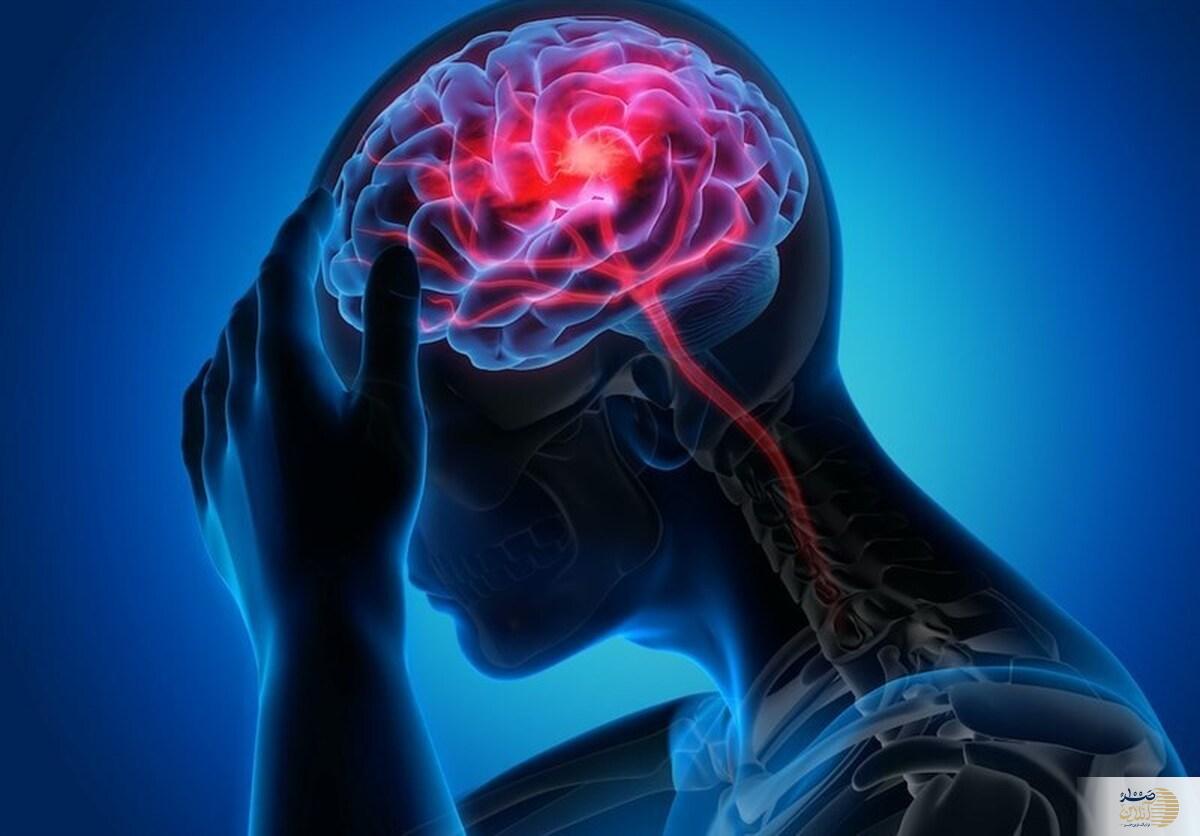 ناگفته های تازه درباره سکته مغزی که باید بدانید