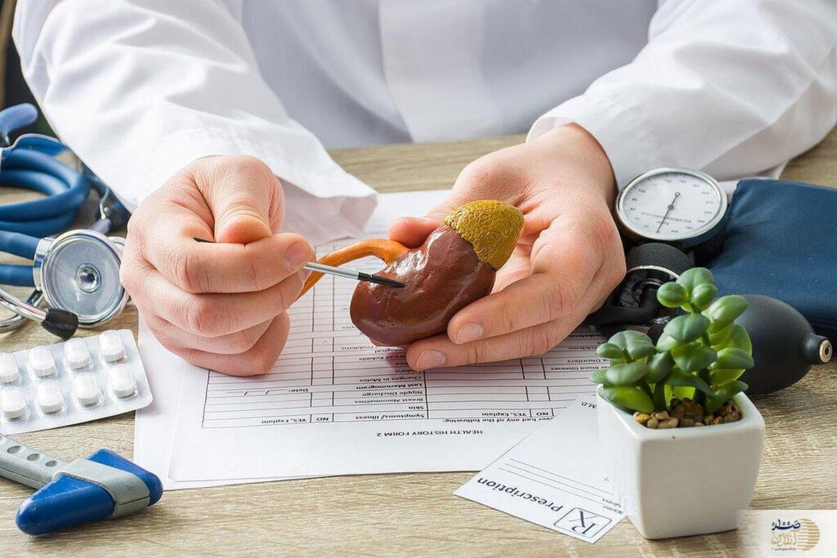 چگونه با رژیم غذایی مناسب از سنگ کلیه جلوگیری کنیم؟