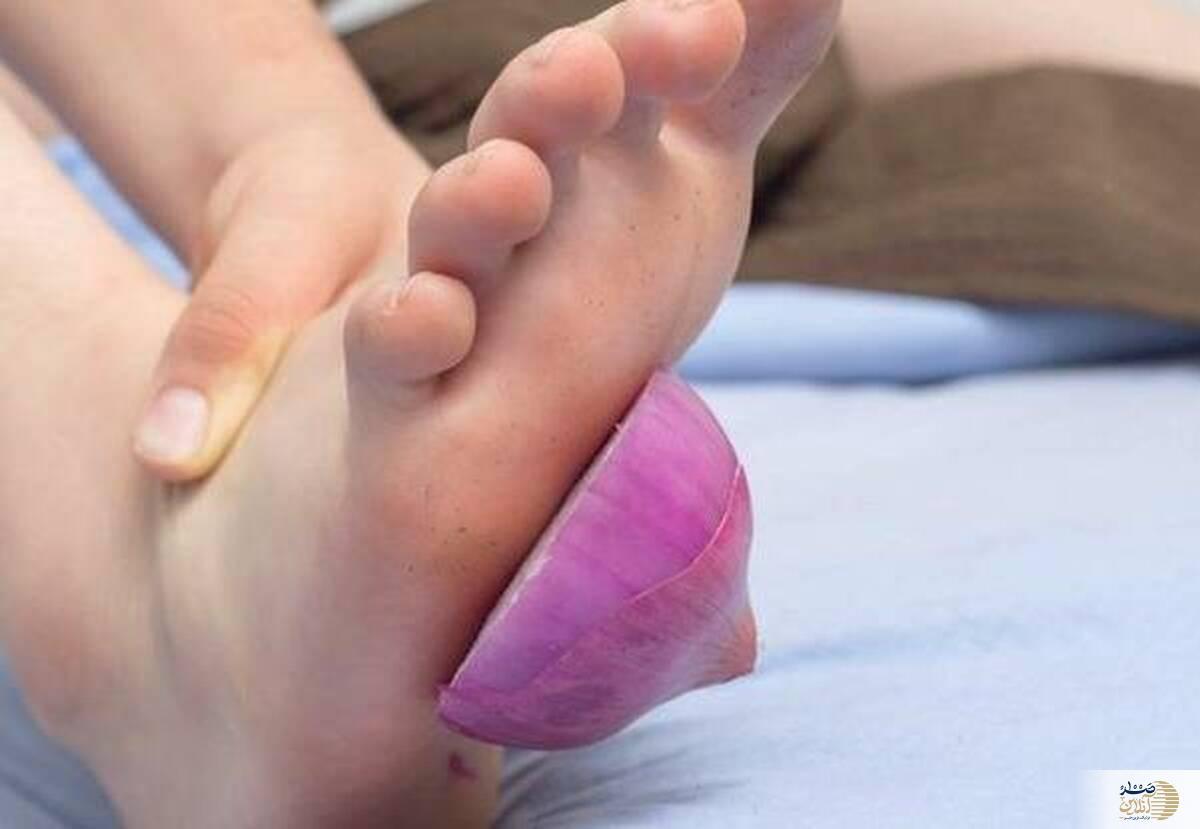 فواید شگفت‌انگیز قرار دادن پیاز در جوراب هنگام شب