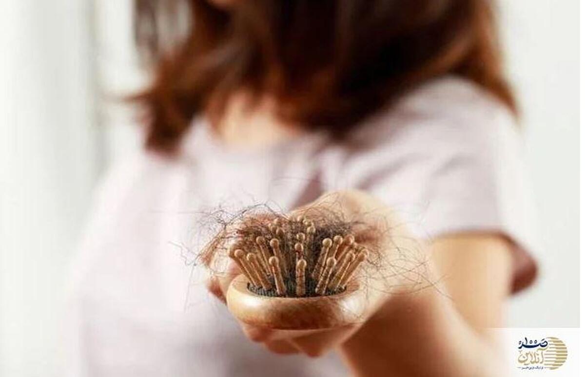 ناخوانده ترین عارضه چاقی/ موهای شما در خطر است!