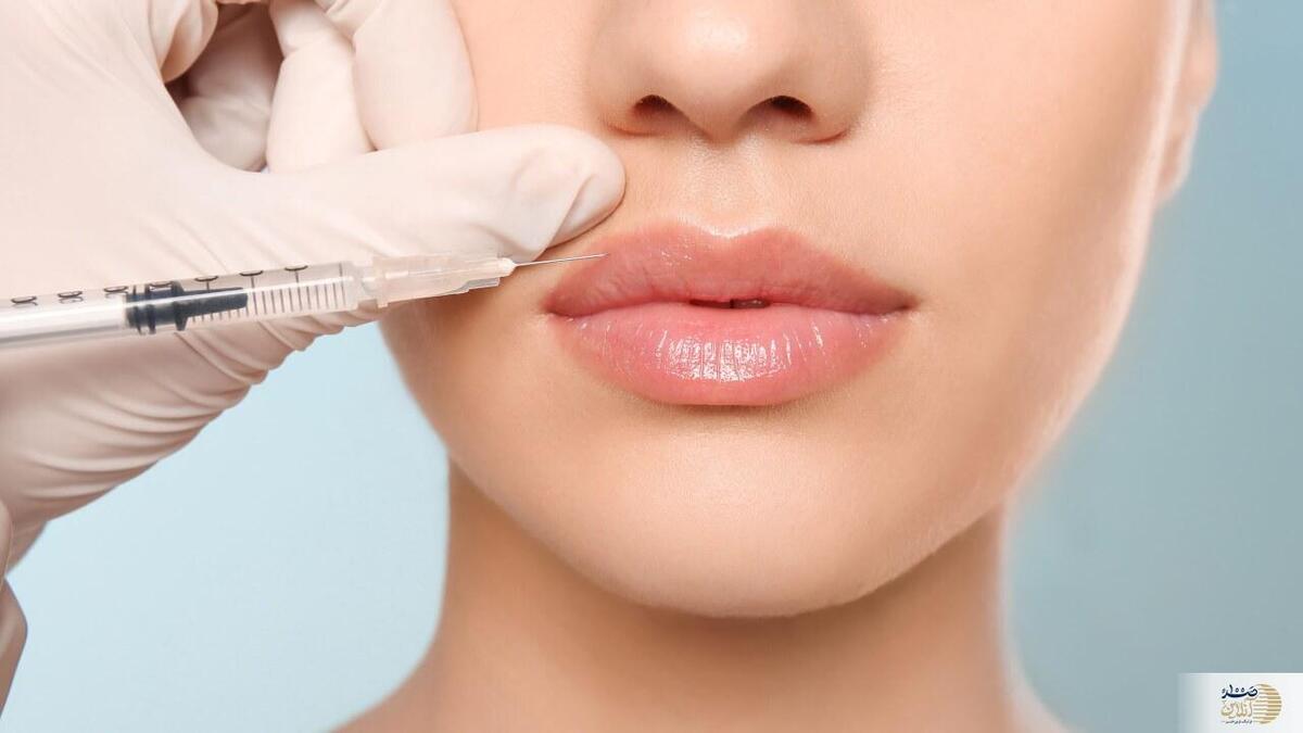 بشنوید| کاربردهای شگفت‌انگیز فیلرها؛ چرا تزریق ژل این‌قدر محبوب شده؟