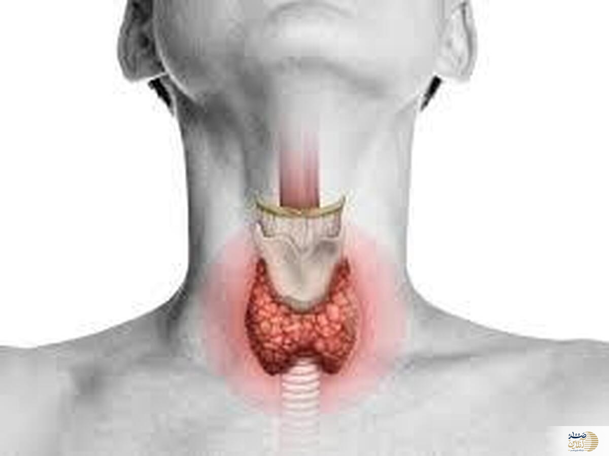 فاش شدن دلایل پرکاری تیروئید/  چرا غده‌ی تیروئید شما بیش‌فعال شده است؟