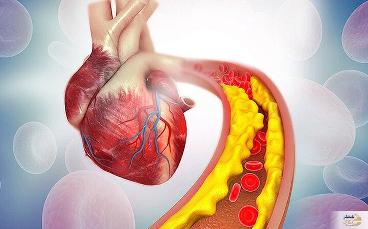 قاتلان خاموش چربی خون/ از این غذاها فرار کنید