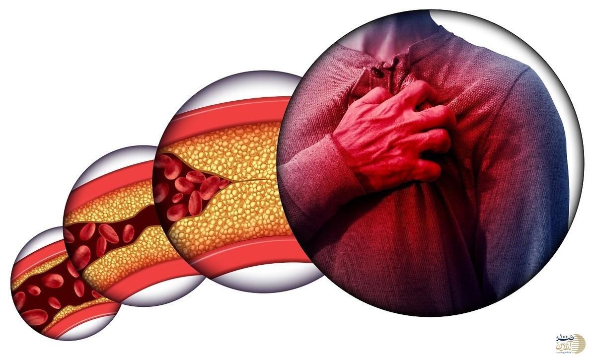 اگر کلسترول دارید، این خوراکی‌ها را همین امروز حذف کنید
