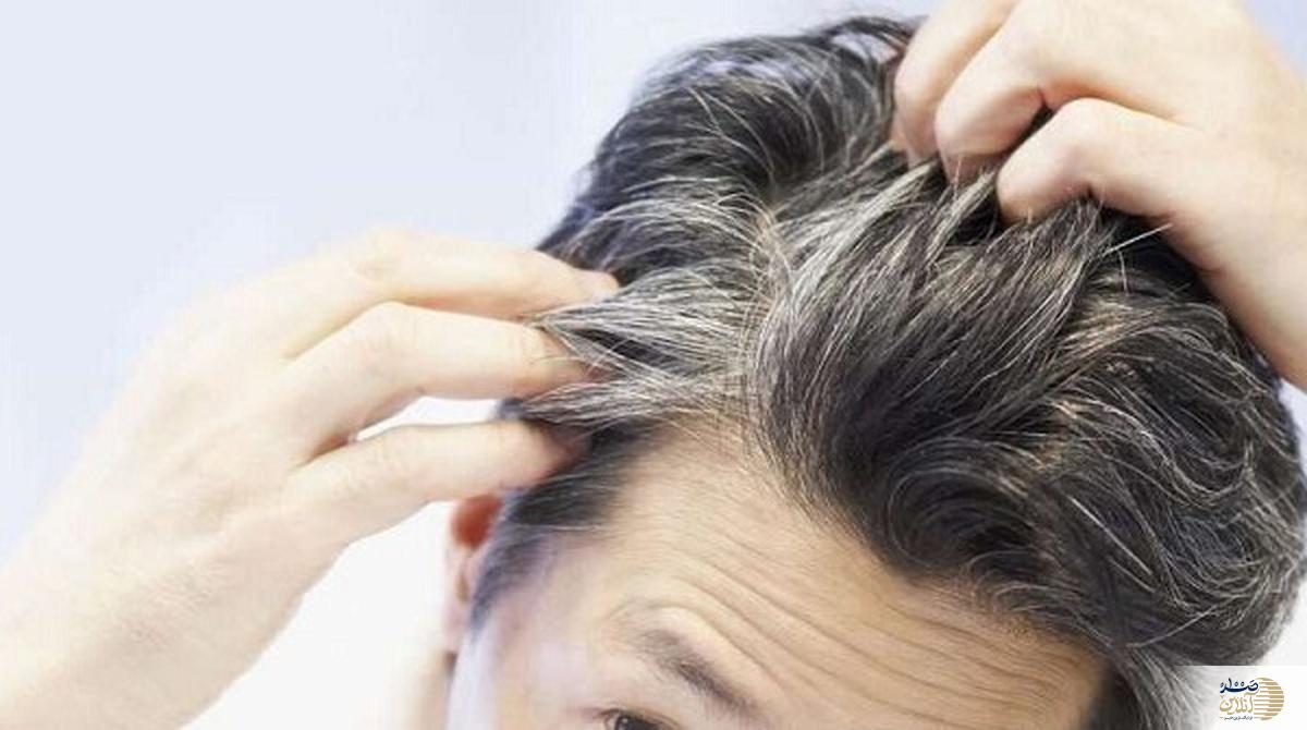 این مشکل شایعه پوست سر را با این روش ساده درمان کنید