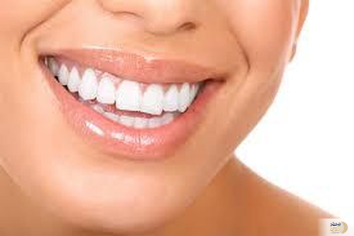 اگر دندان های عین برف سفید و سالم میخواهید این ویتامین را بخورید
