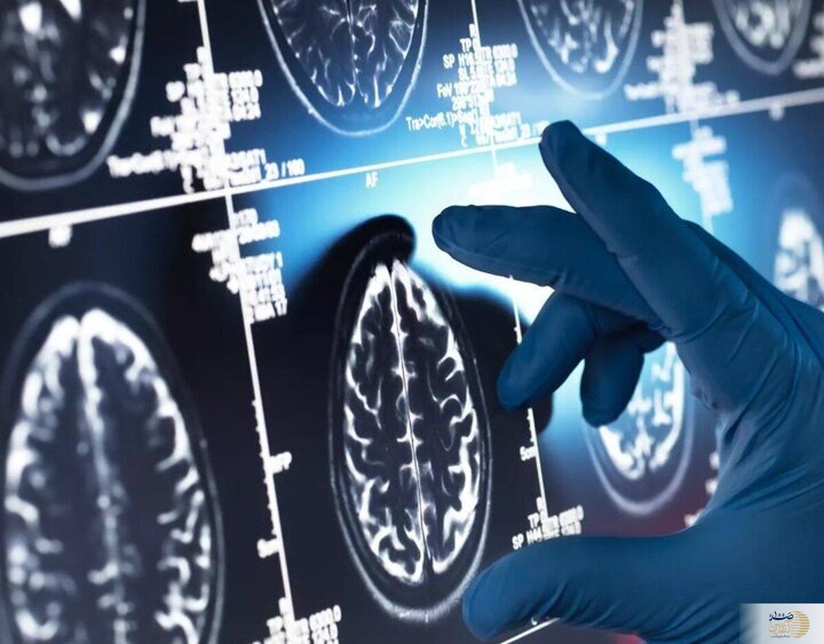 با این گیاه معروف آلزایمر را دور بزنید