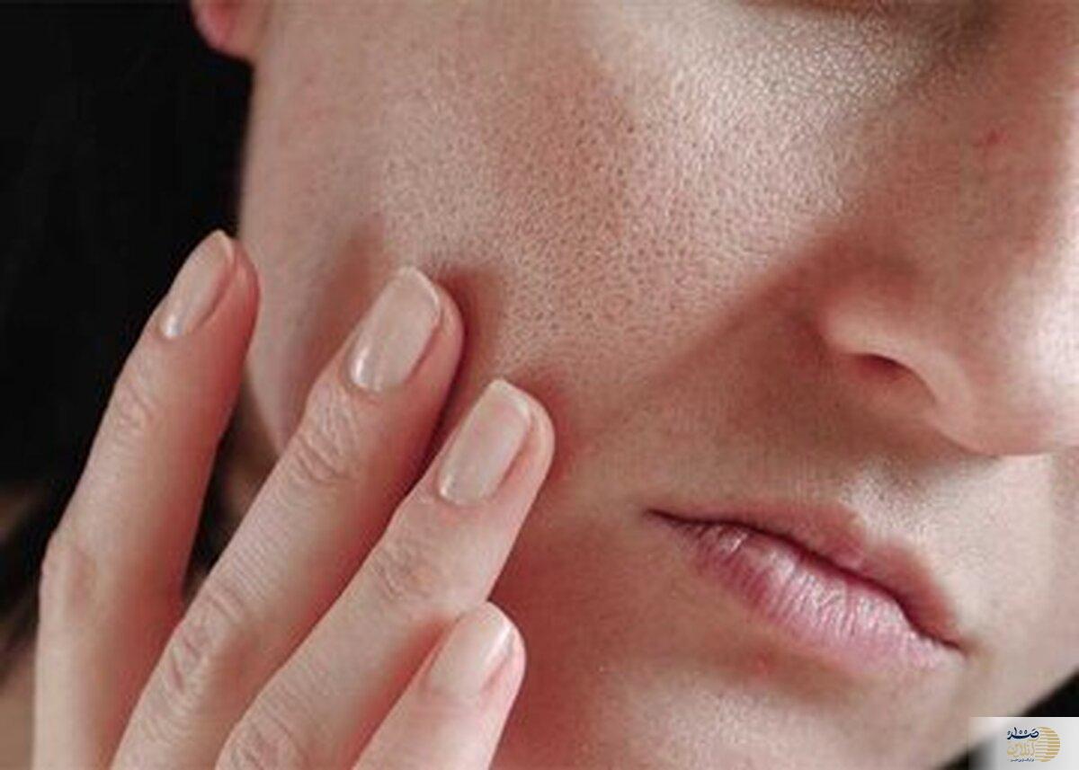 دوست دارید پوستی روشن داشته باشید/ این مطلب مخصوص شماست