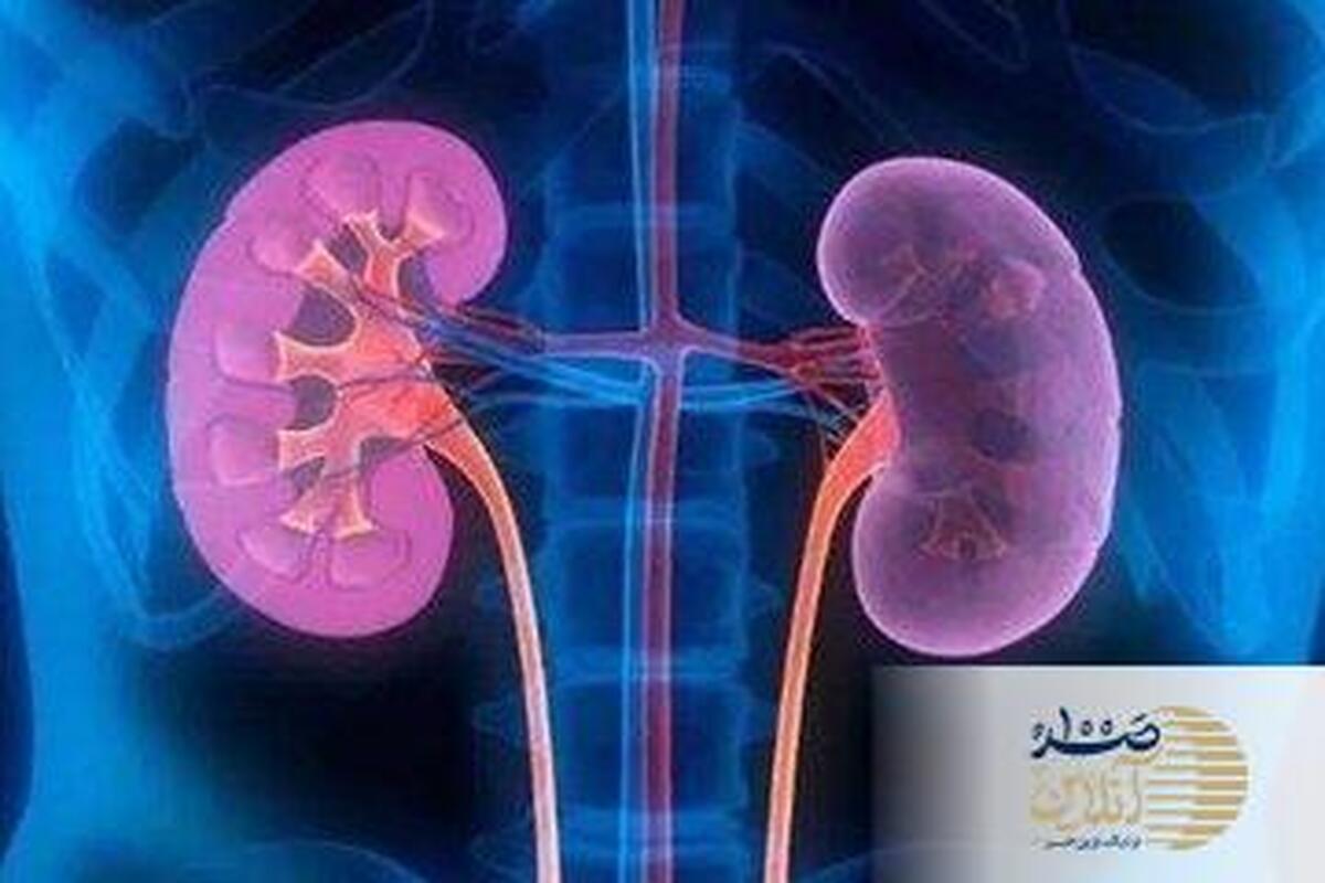 آیا واقعا مشروبات الکی سنگ کلیه را درمان میکند؟
