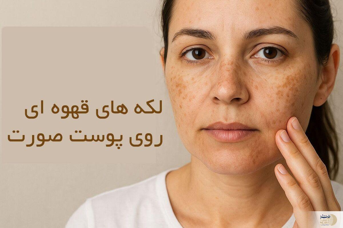 این نوع لکه ها روی پوست جای نگرانی دارید به پزشک مراجعه کنید