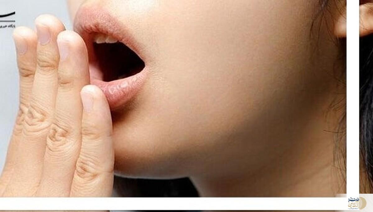 از بوی بد دهان کلافه شده اید این راه حل برای شماست