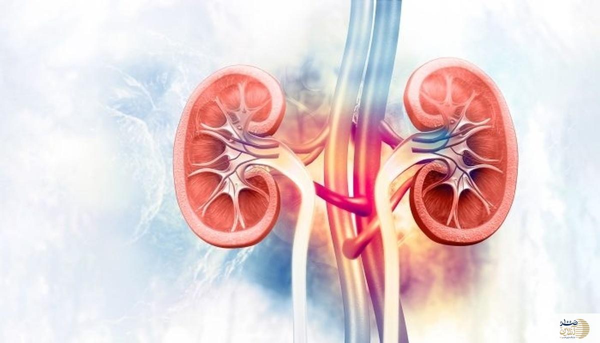 با شروع فصل سرما چرا مشکلات مربوط به سنگ کلیه بیشتر می‌شود؟