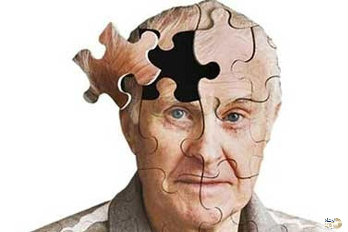 آیا شکل مغز آینده زوال عقل را فاش می‌کند؟   نشانه‌های پنهان که باید مراقبشان بود