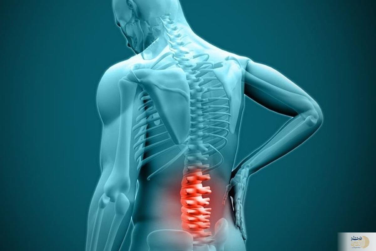 مهمترین عوامل آرتروز و دیسک کمر را بشناسید