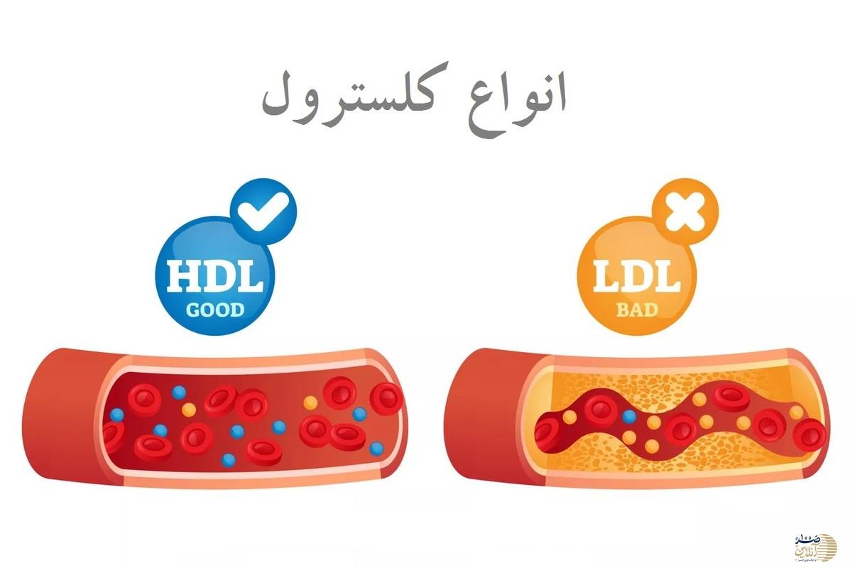 این غذاها دشمن کلسترول بد هستند بیشتر مصرف کنید