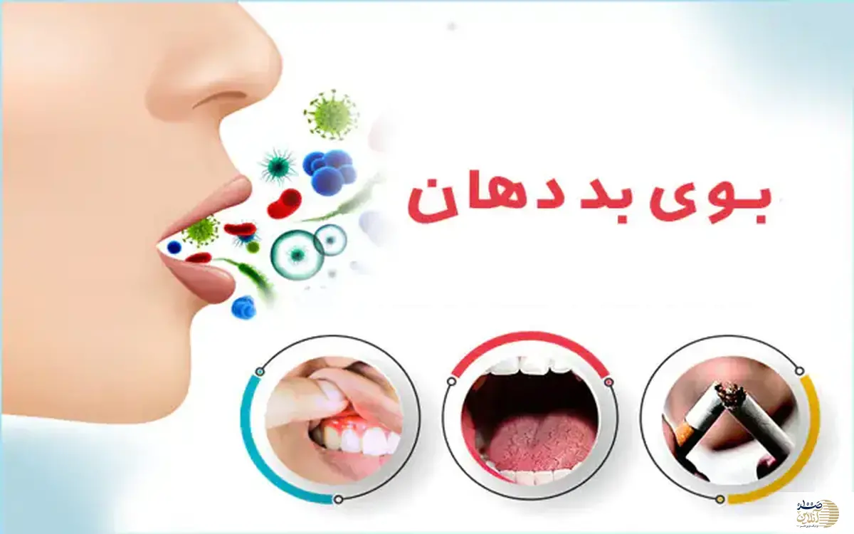 اگر بخاطر بوی بد دهان خجالت می کشید بخوانید