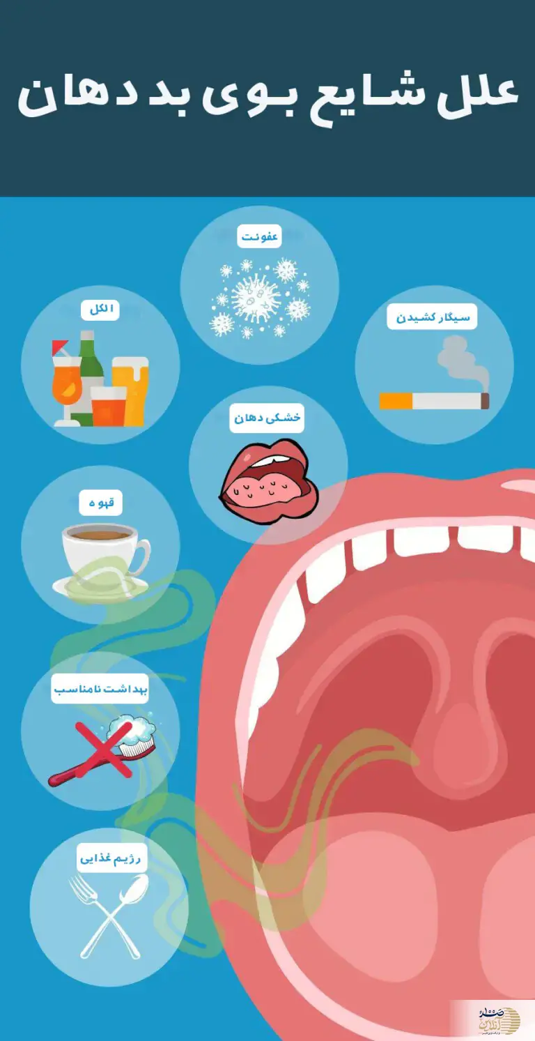 اگر بخاطر بوی بد دهان خجالت می کشید بخوانید اگر بخاطر بوی بد دهان خجالت می کشید بخوانید