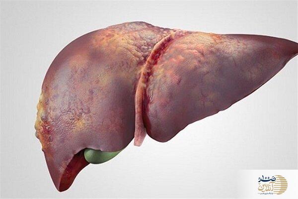 وقتی کبد فریاد می‌زند، از خستگی مزمن تا درد شکم