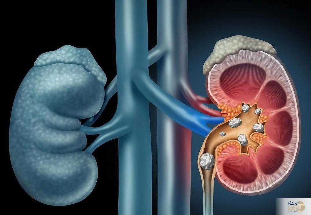 بخاطر این دلایل مهم صبحانه ارده و شیره بخورید بخاطر این دلایل مهم صبحانه ارده و شیره بخورید