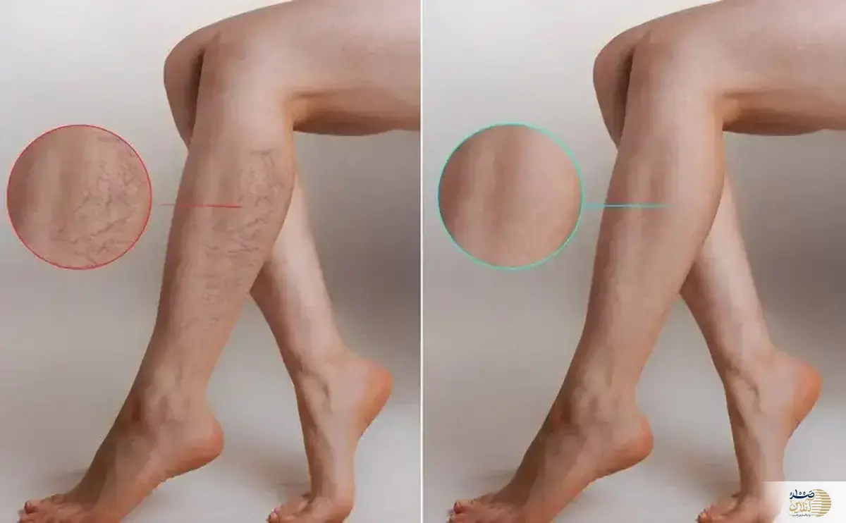 چرا این بیماری خطرناک شد؟