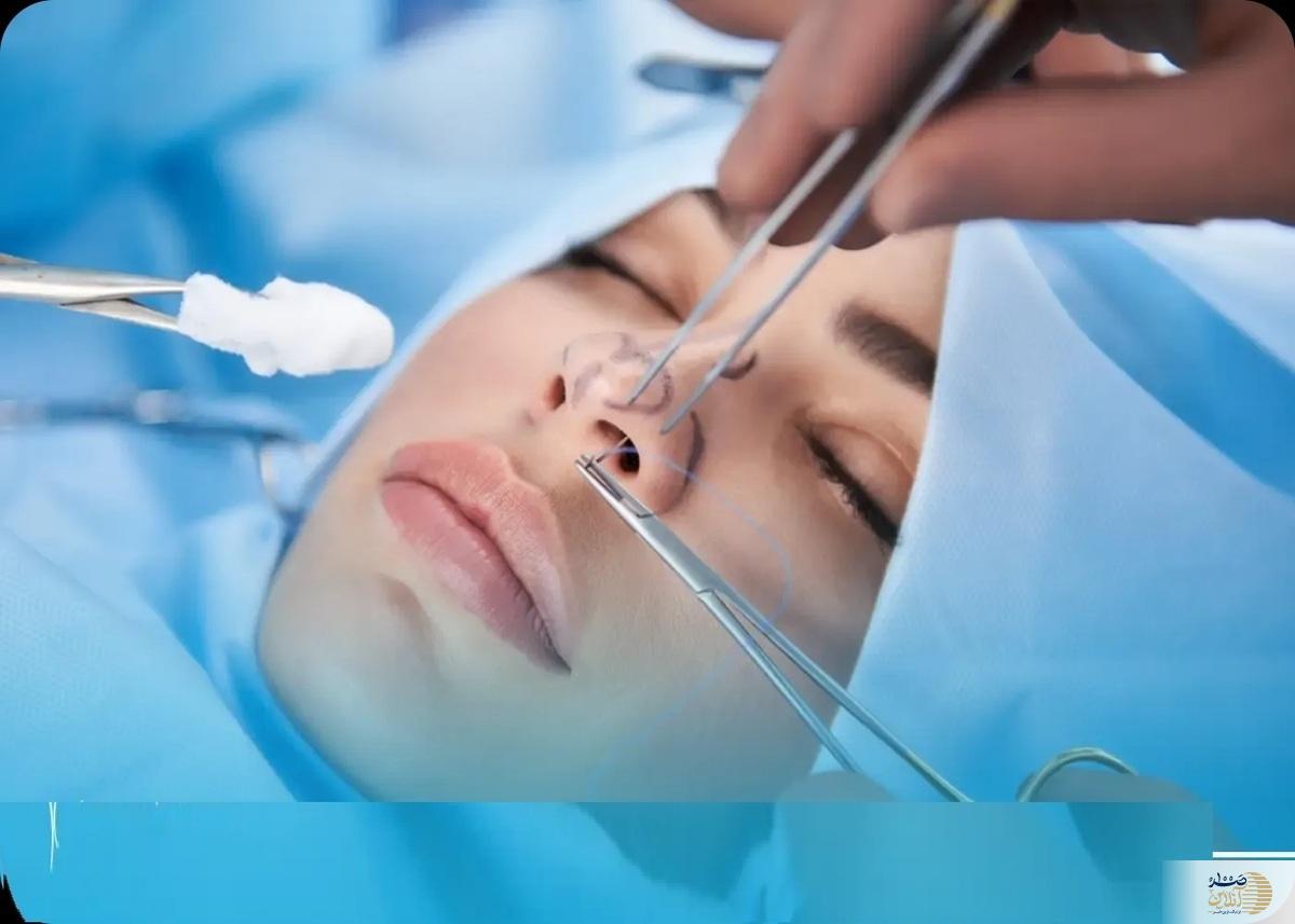 جراحی بینی با دستیار دیپلمه خبرساز شد
