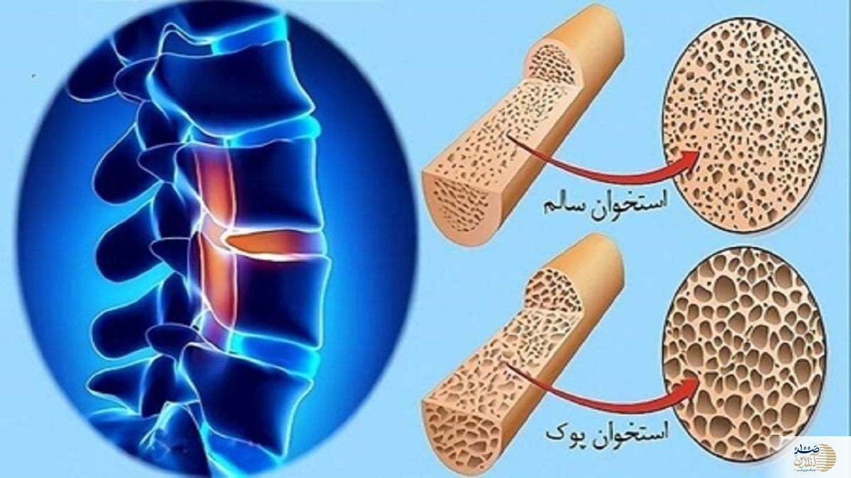 اگر بالای ۶۰ سال هستید این ویتامین از نان شب برای شما واجب تر است