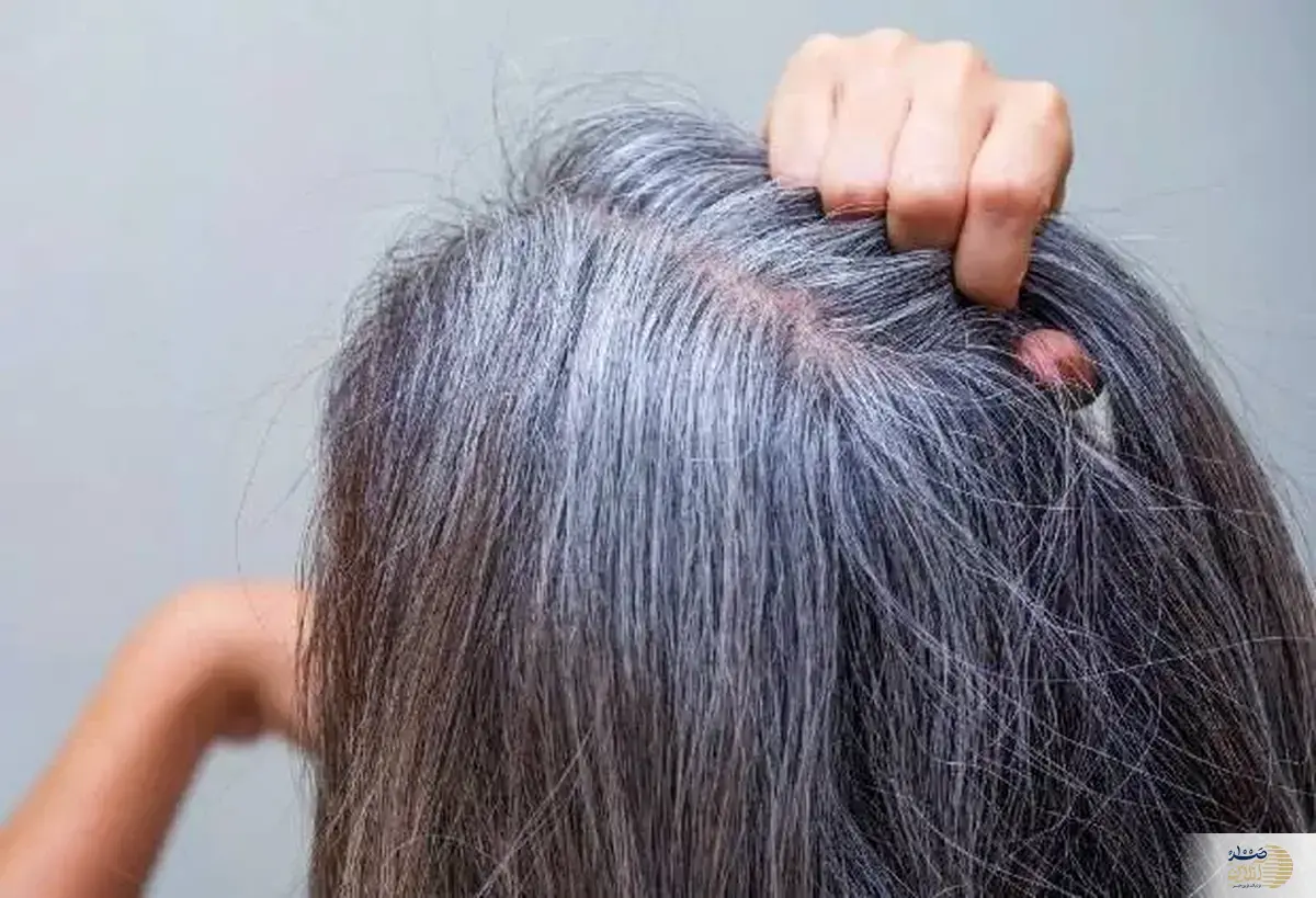 باورهای اشتباه درباره سفید شدن مو که تا الان نمی دانستید