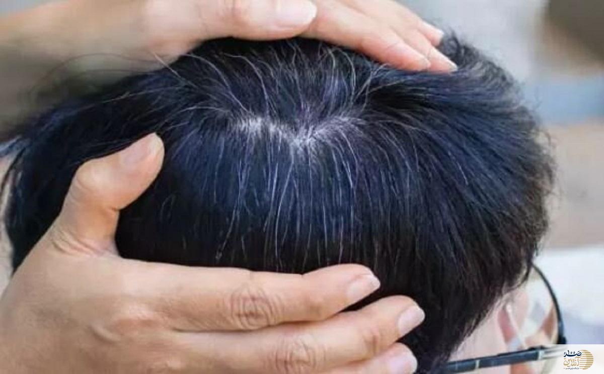 این موارد را درباره موی سفید تا الان نمی دانستید