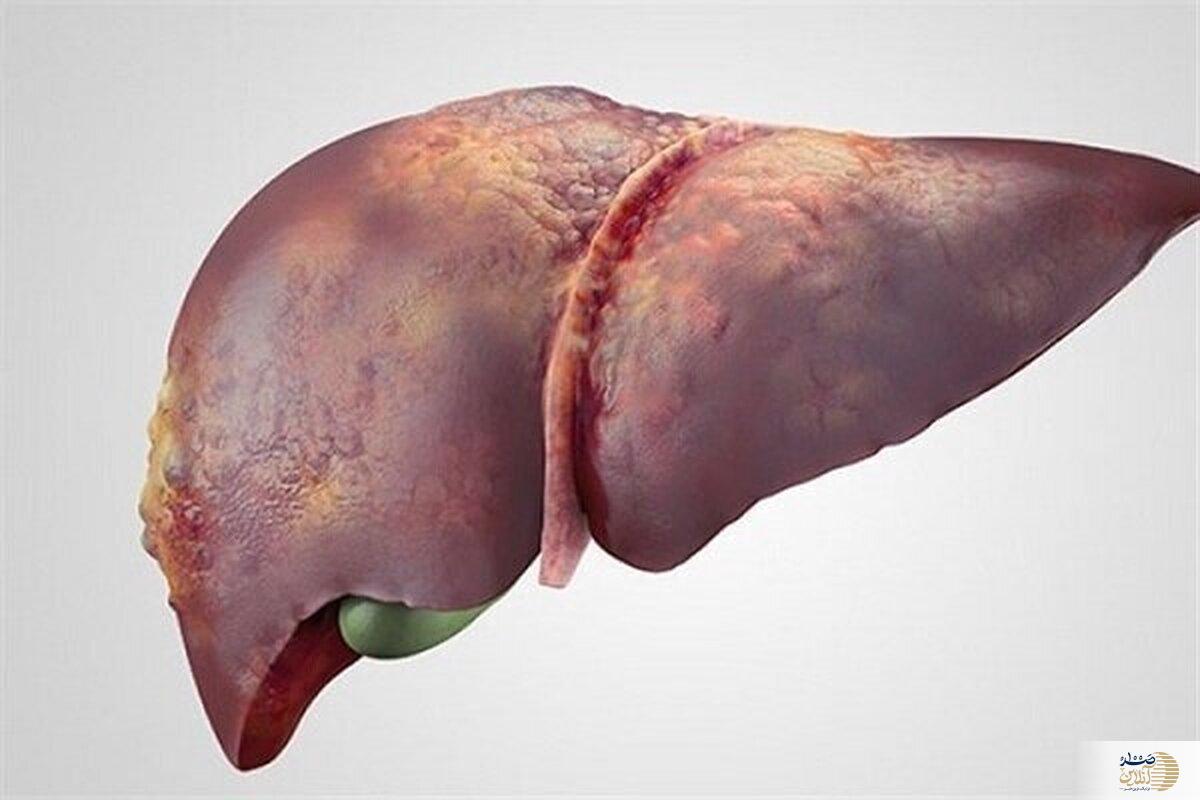 ناگفته های تازه درباره هپاتیت