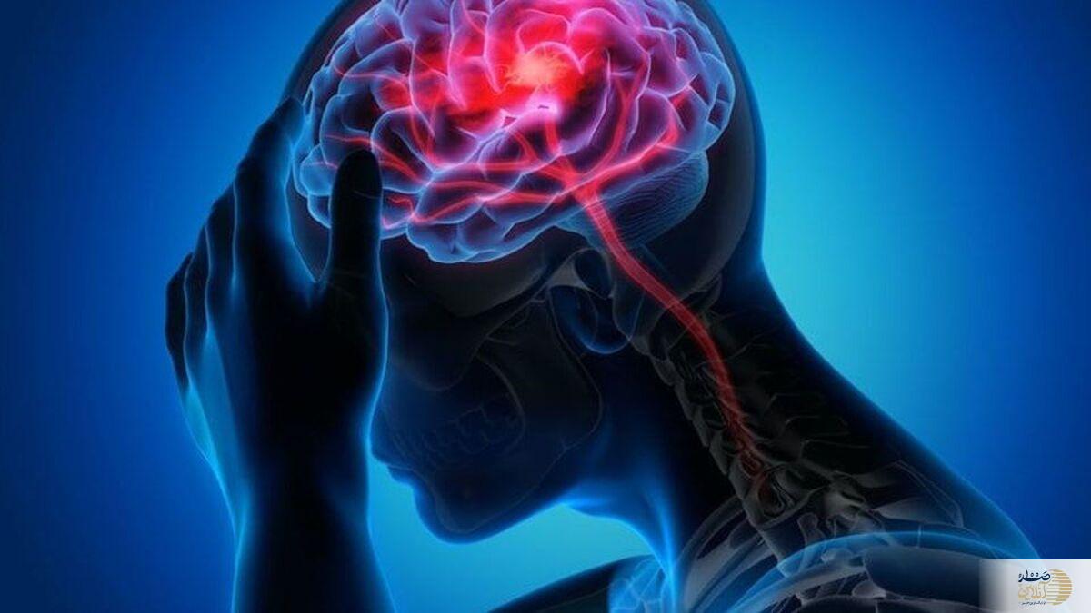 دانستن علائم سکته مغزی برای هر فردی لازم و ضروری است