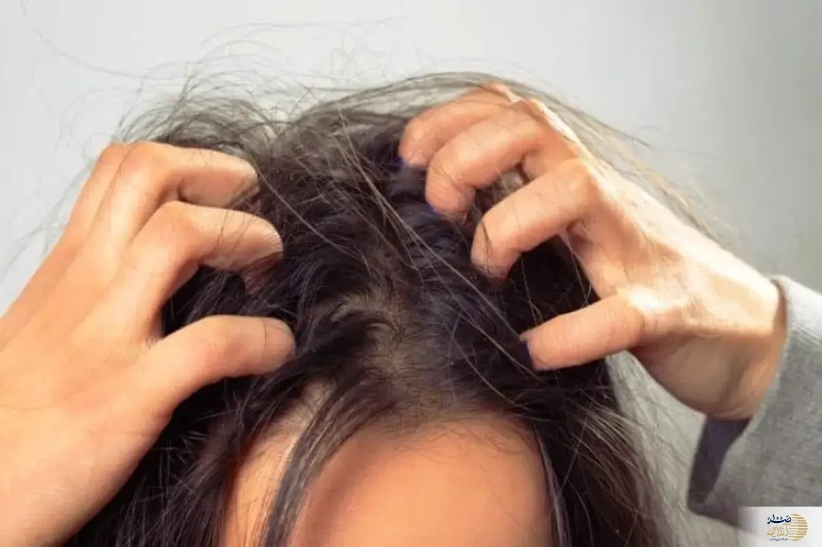 نشانه های که به شما می گوید شپش دارید