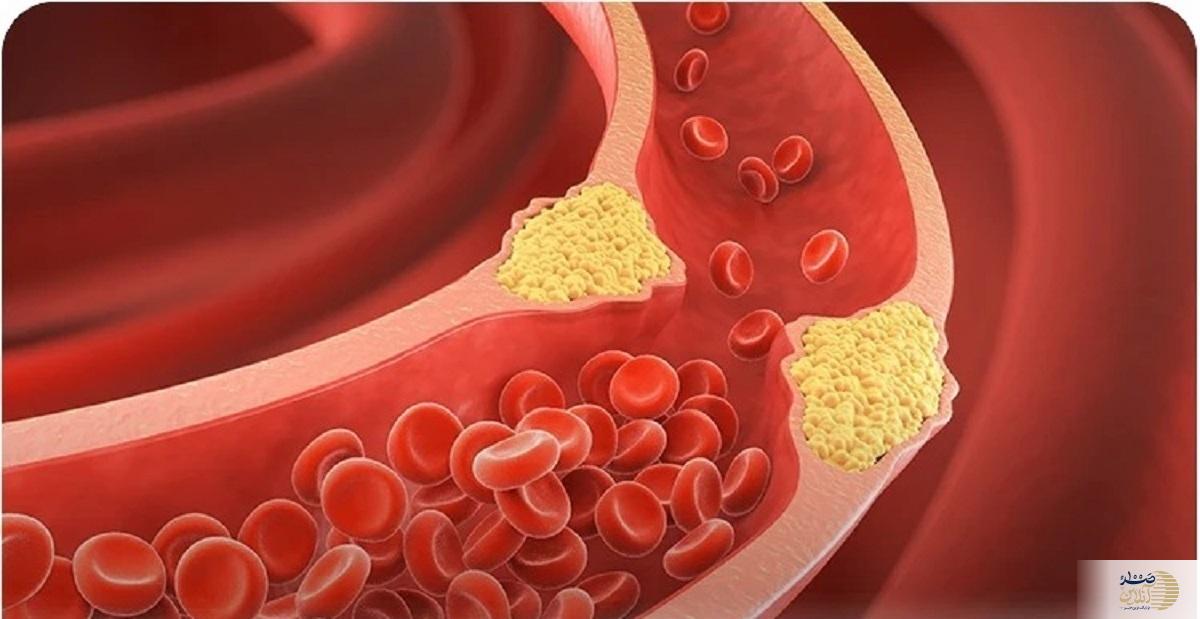 این خوارکی ها معجزه ای برای چربی خون هستند