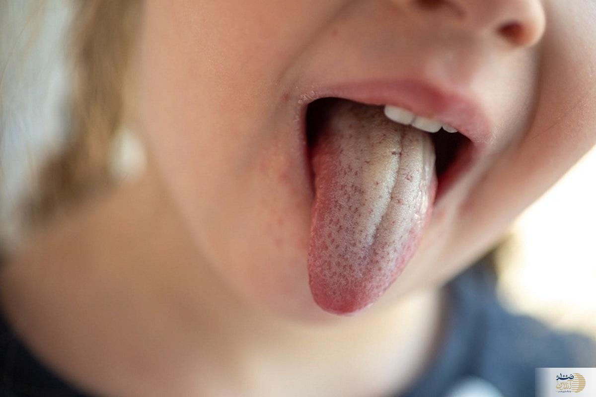 چرا دهان برفک می زند؟