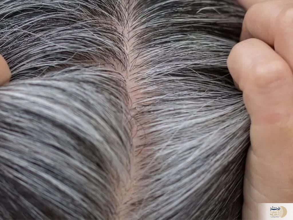 موی شما در جوانی سفید می شود یعنی این ویتامین بدن تان کم است