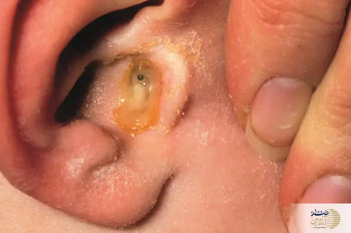 این علایم یعنی گوش شما عفونت دارد