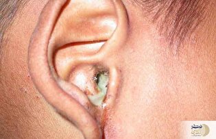 این علایم یعنی گوش شما عفونت دارد