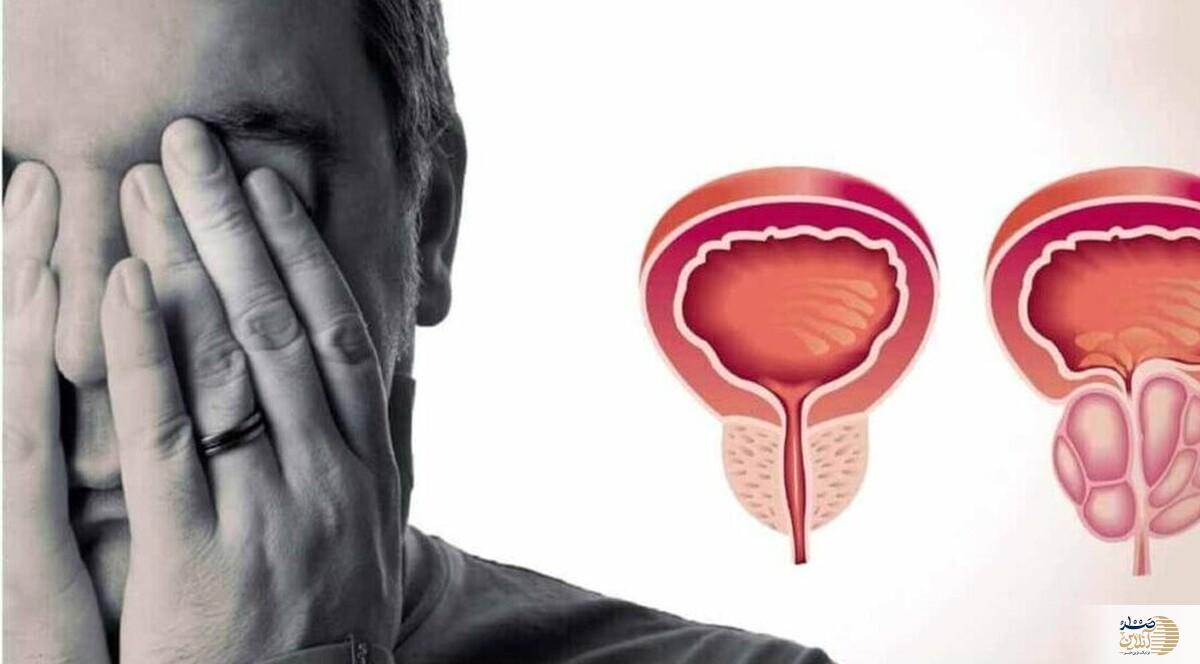مردان این علایم را جدی بگیرند