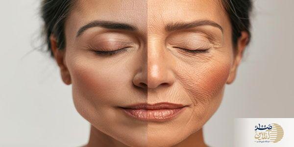 آلو خشک در وعده صبحانه،  یک سوپرفود قدرتمند برای سلامت بدن