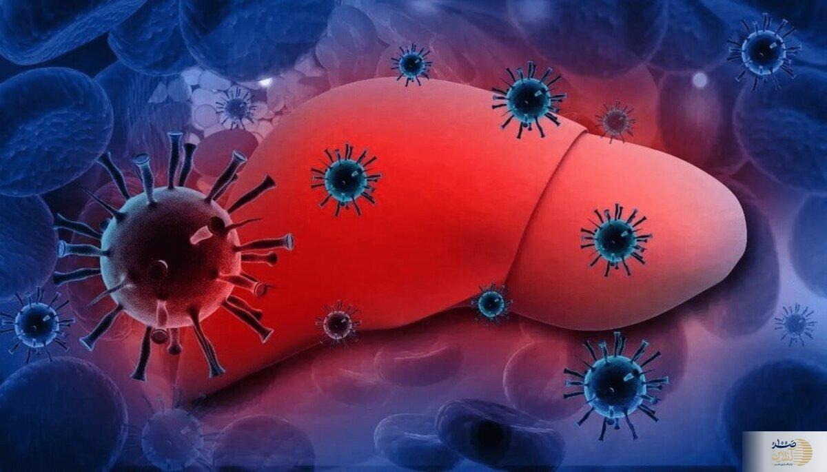این مشکل کبد را جدی بگیرید